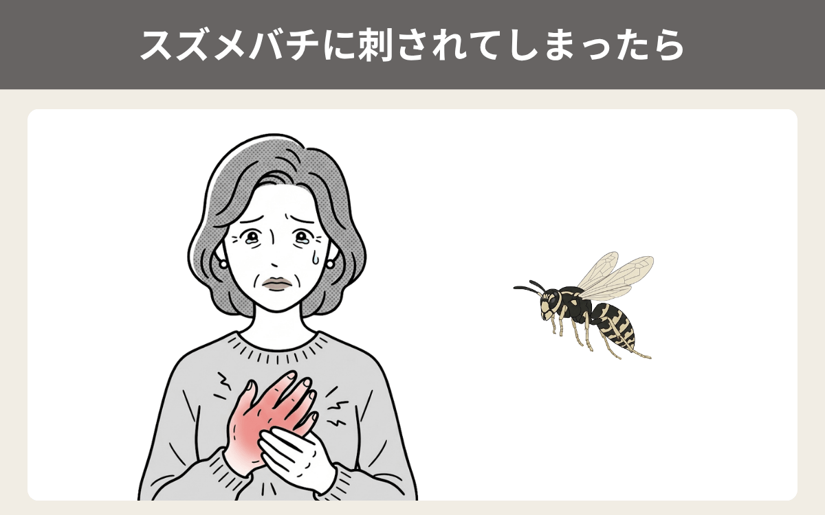 シロオビホオナガスズメバチに刺されてしまったら