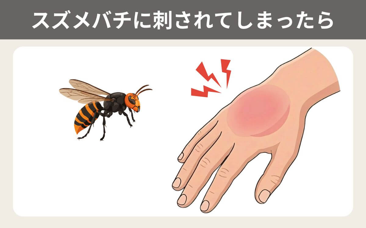 スズメバチに刺されてしまったら