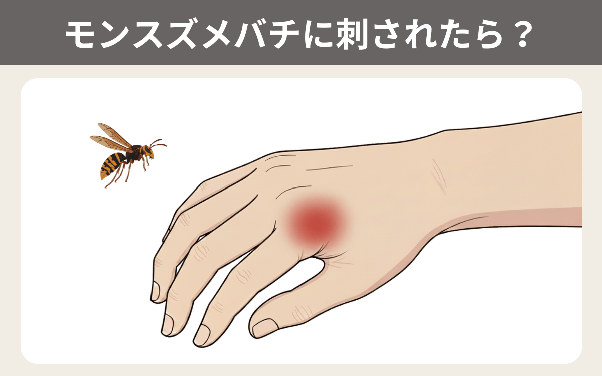モンスズメバチに刺されたら？