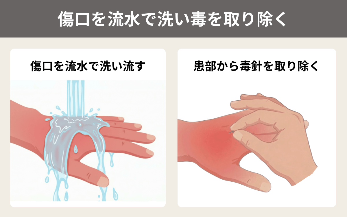 傷口を流水で洗い毒を取り除く 1