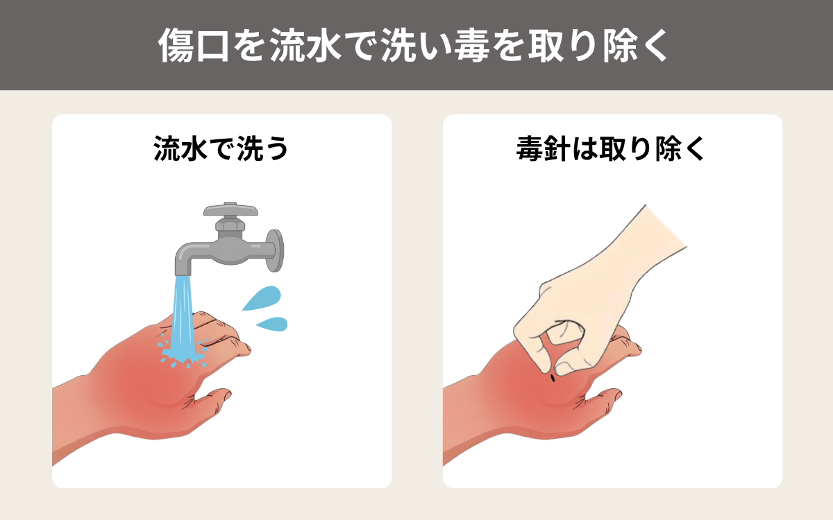 傷口を流水で洗い毒を取り除く 3