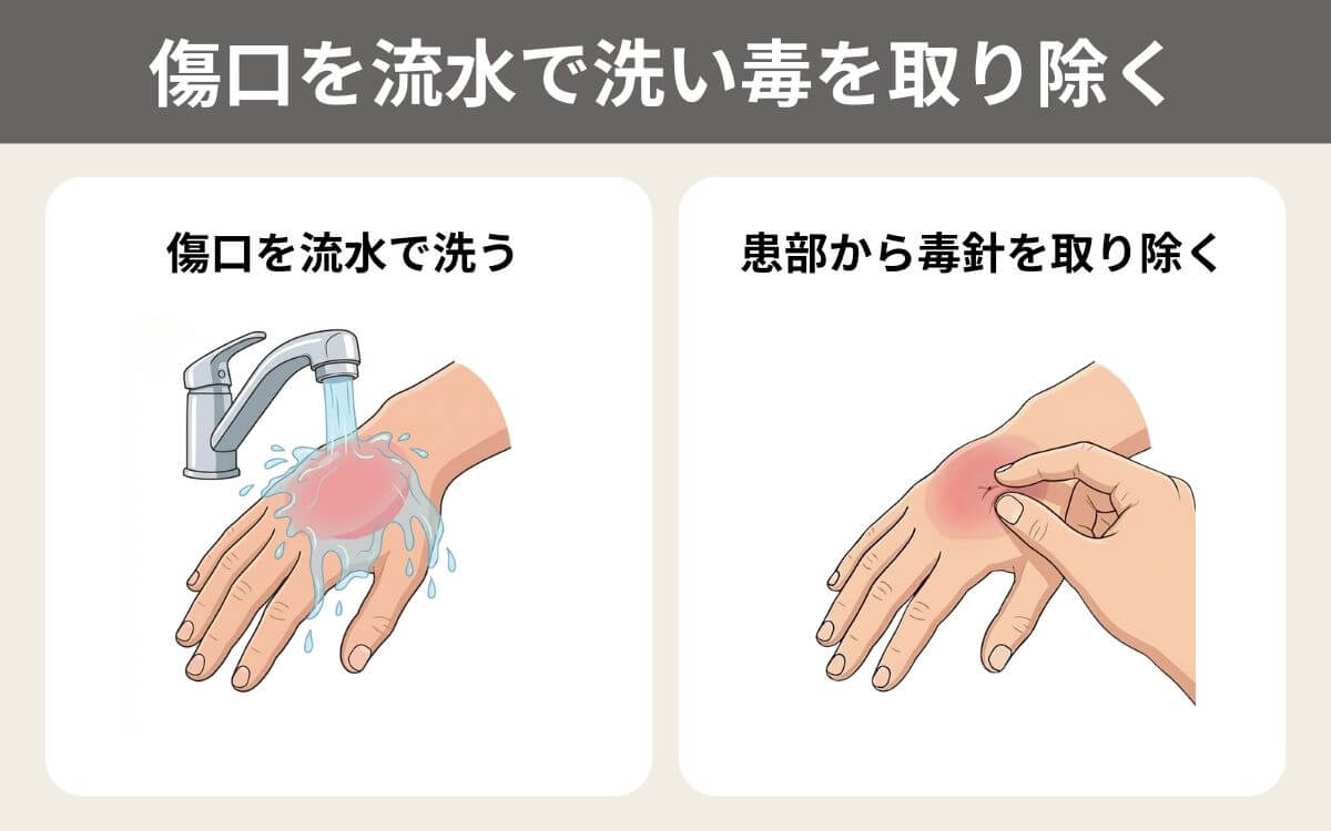 傷口を流水で洗い毒を取り除く