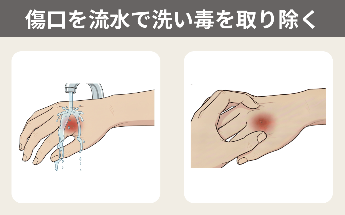傷口を流水で洗い毒を取り除く