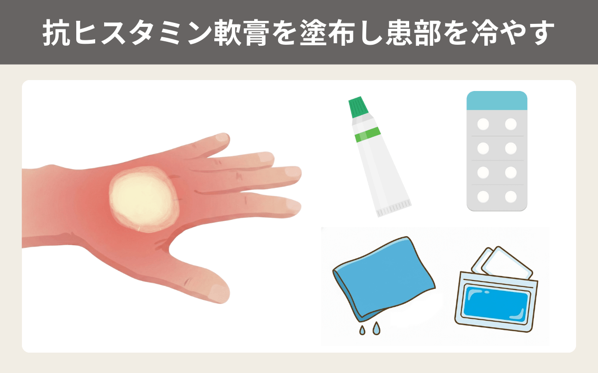 抗ヒスタミン軟膏を塗布し患部を冷やす 1