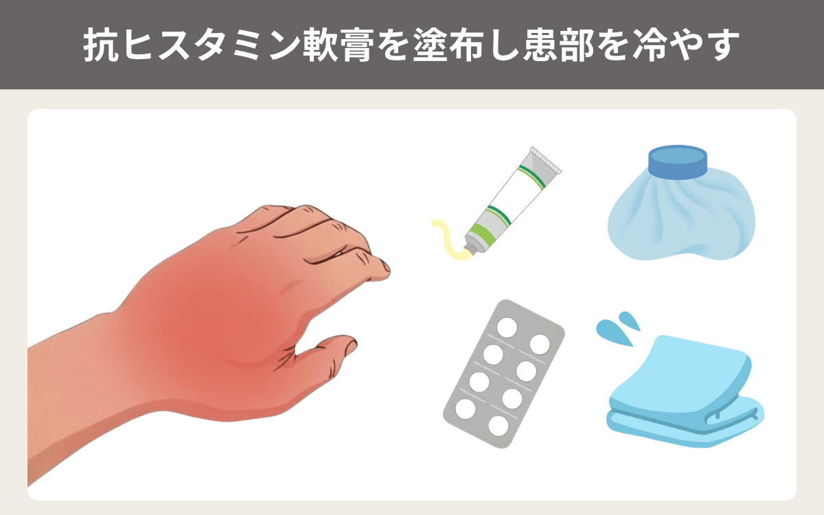 抗ヒスタミン軟膏を塗布し患部を冷やす 3