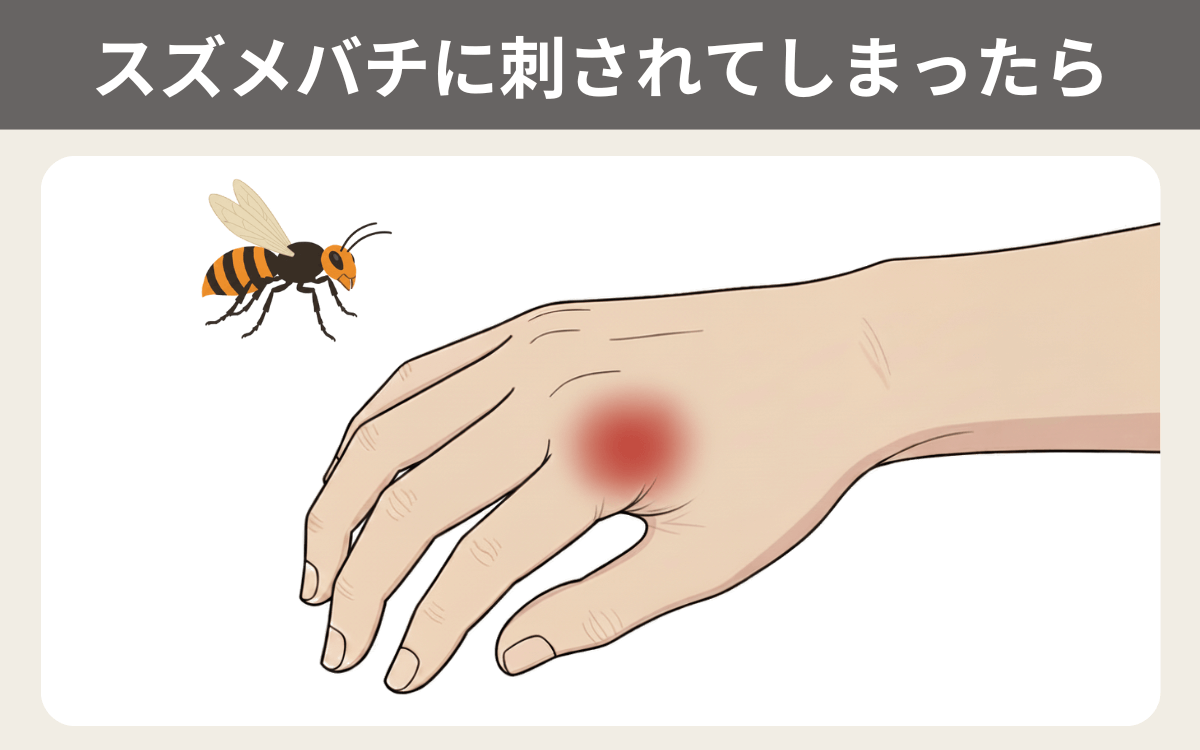 スズメバチに刺されてしまったら