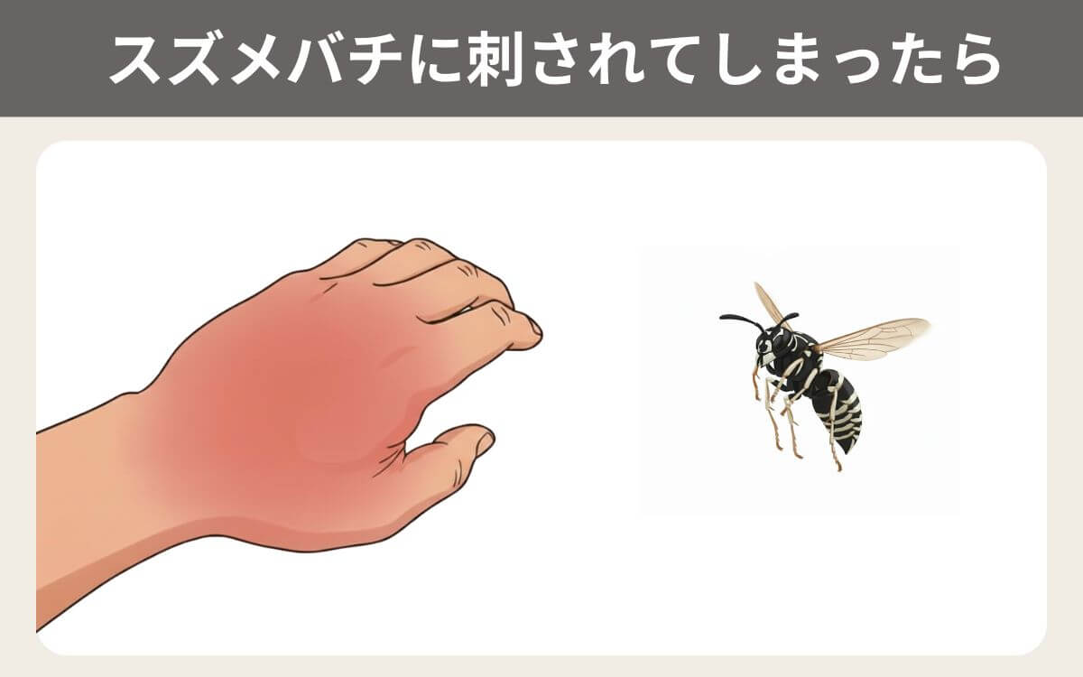シダクロスズメバチに刺されてしまったら