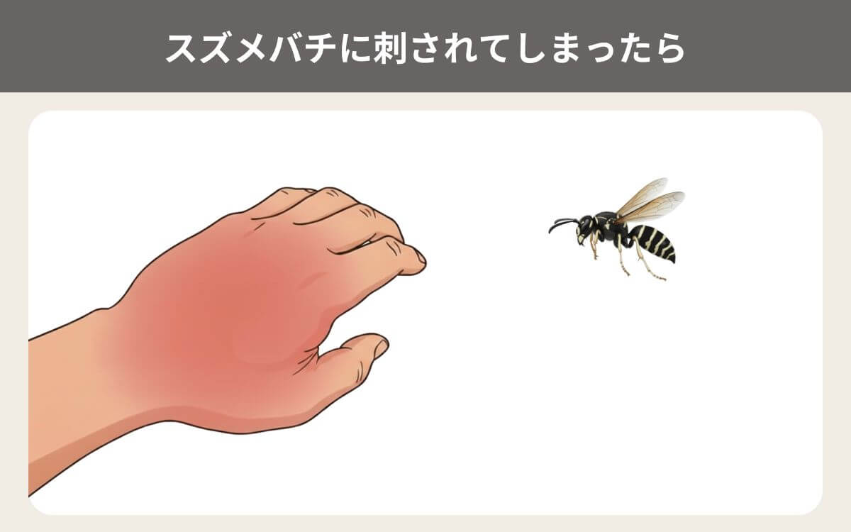 ニッポンホオナガスズメバチに刺されてしまったら