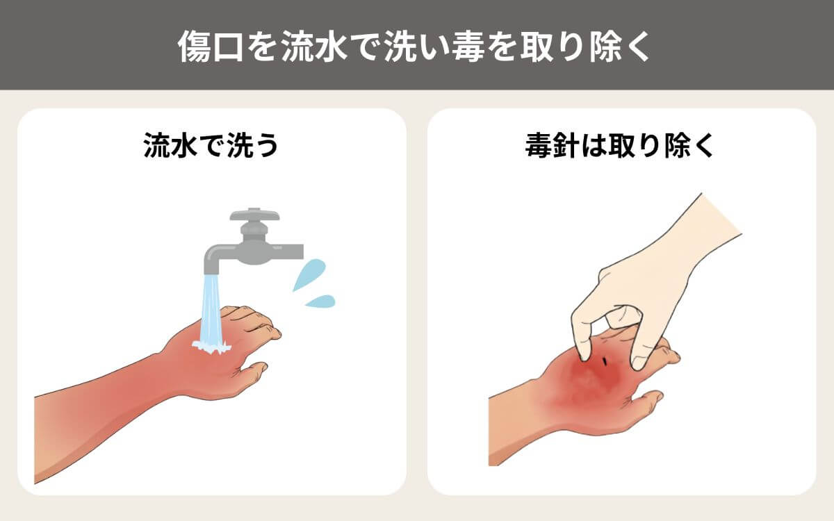 傷口を流水で洗い毒を取り除く 1