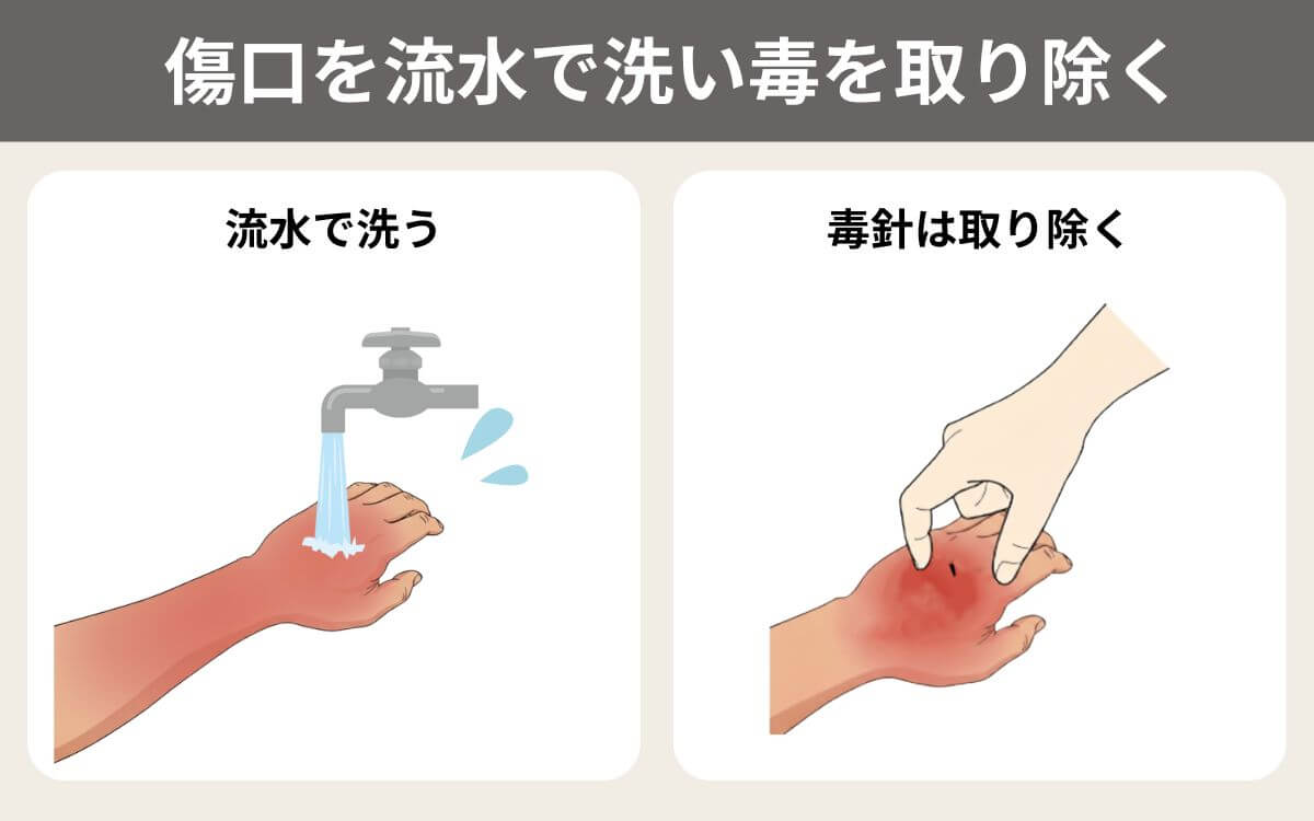 傷口を流水で洗い毒を取り除く