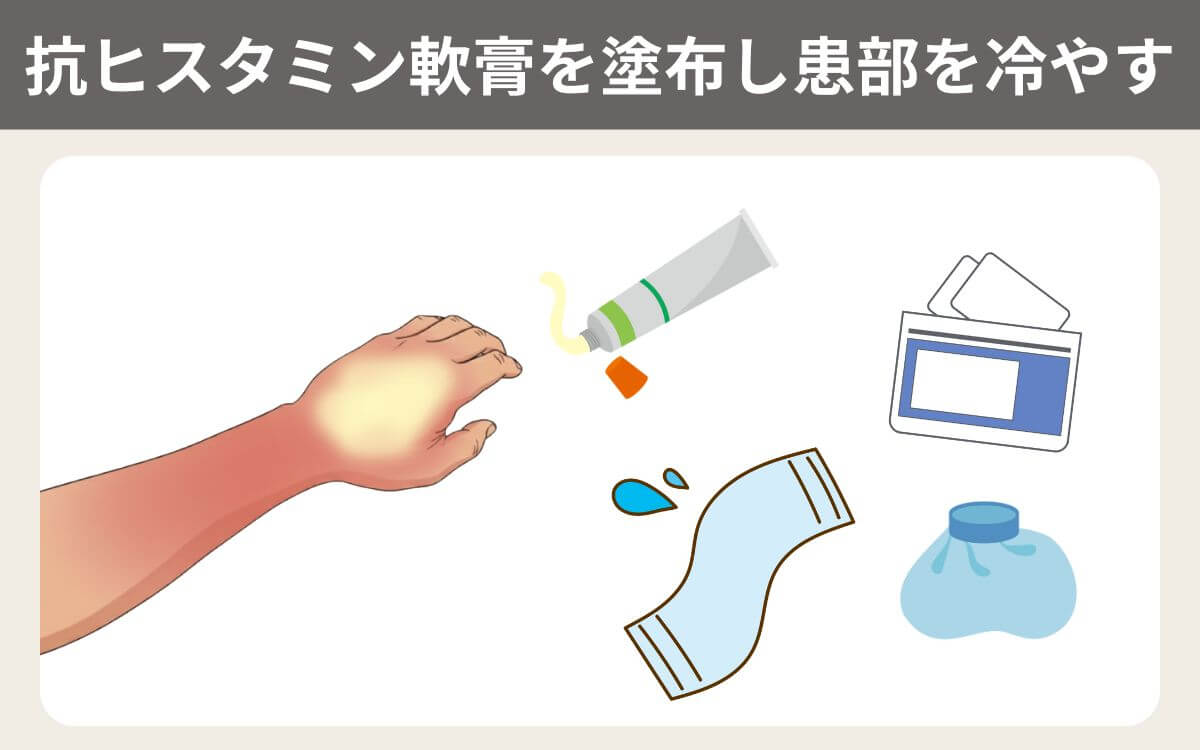 抗ヒスタミン軟膏を塗布し患部を冷やす