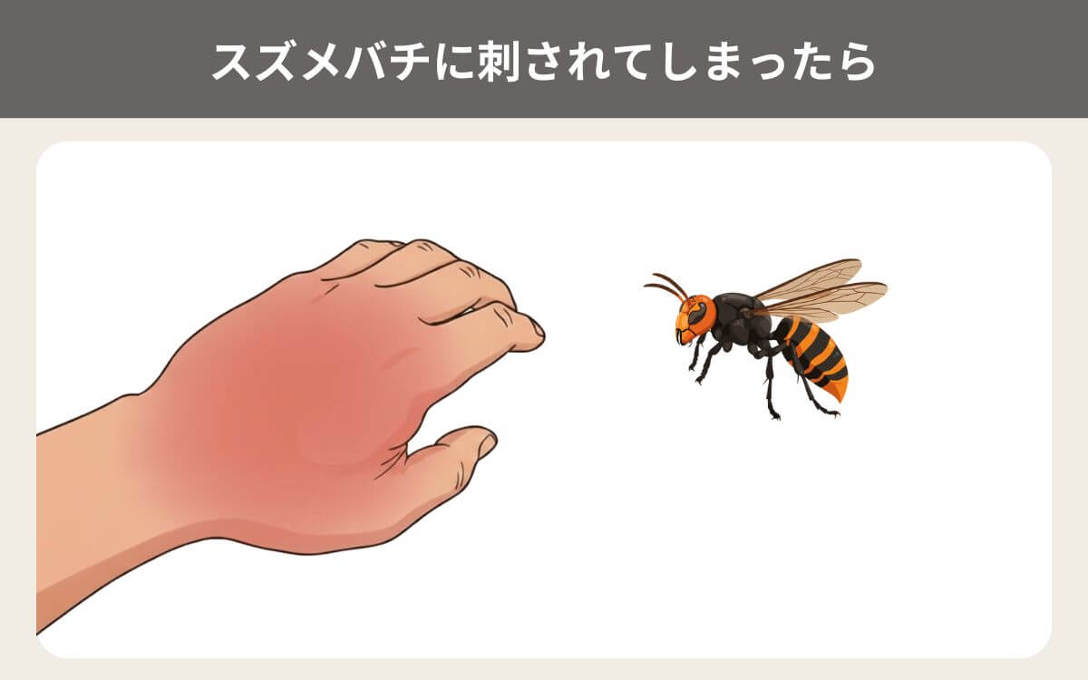 スズメバチに刺されてしまったら