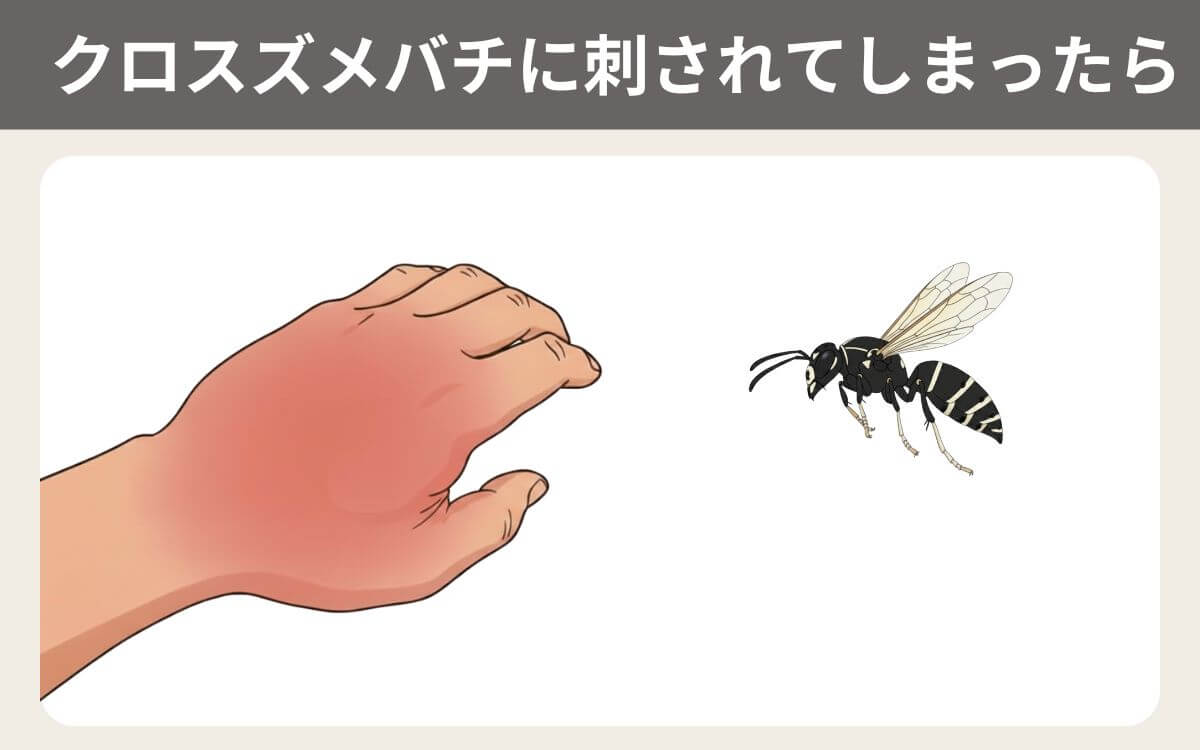 クロスズメバチに刺されてしまったら