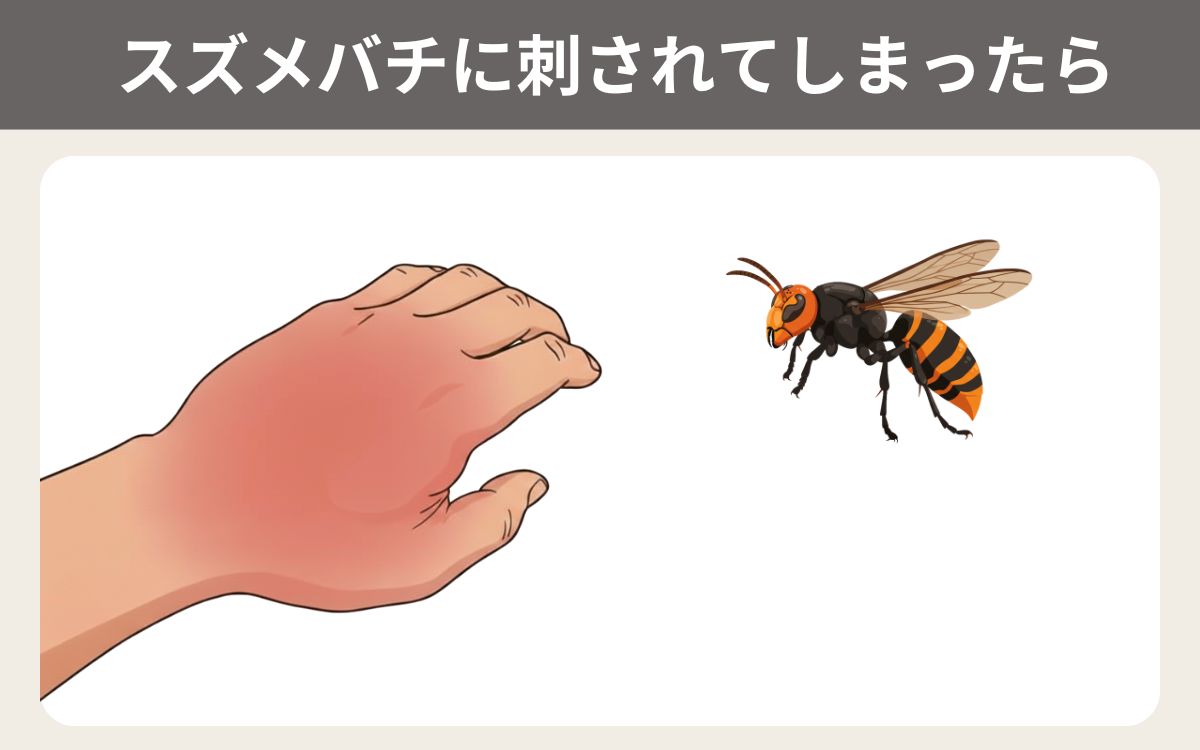 スズメバチに刺されてしまったら