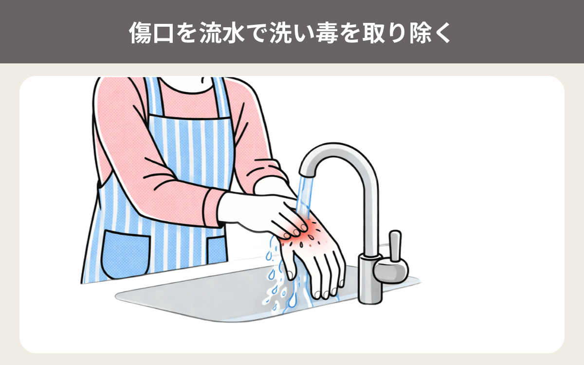 傷口を流水で洗い毒を取り除く