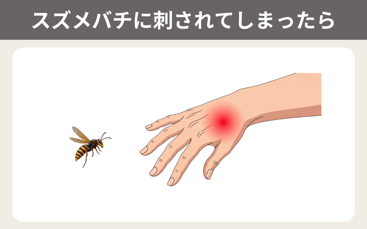 コガタスズメバチに刺されたら？
