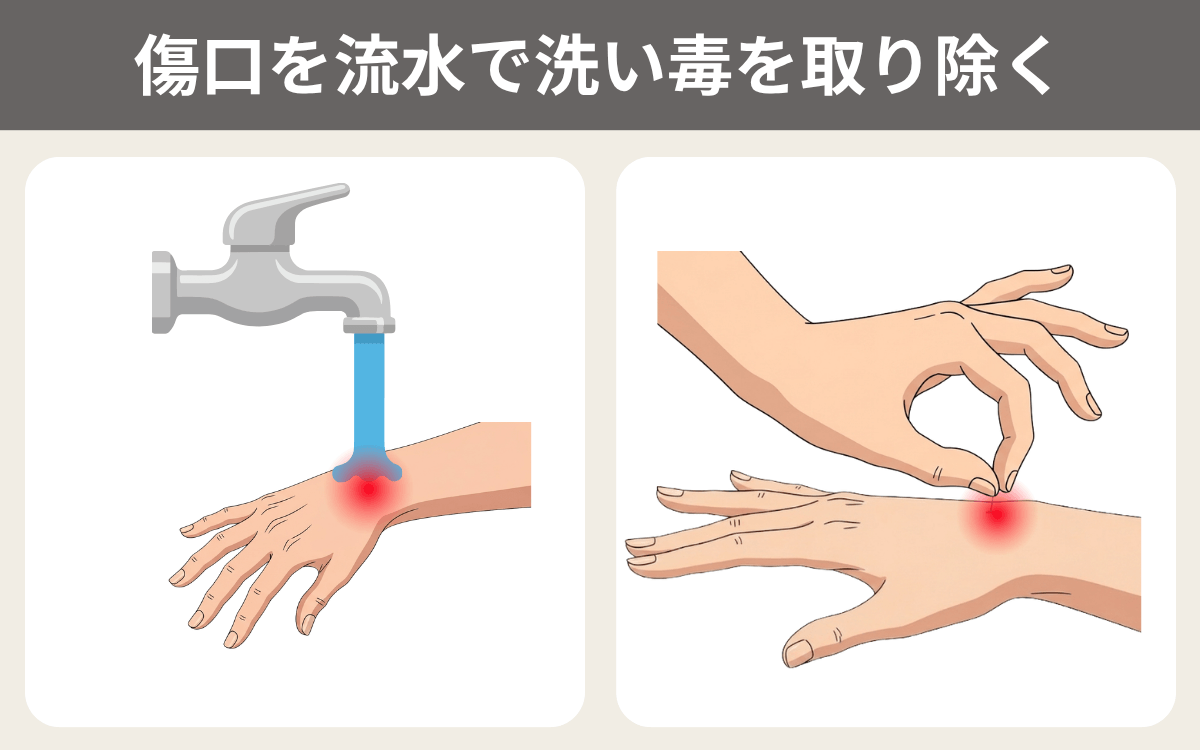 傷口を流水で洗い毒を取り除く 1