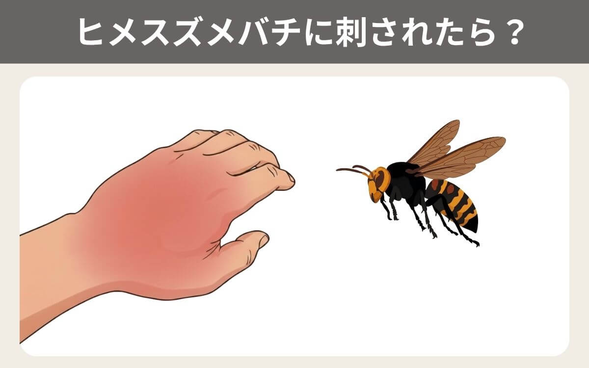 ヒメスズメバチに刺されたら？