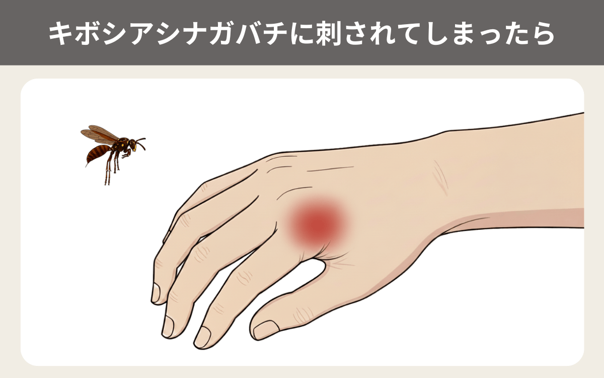 キボシアシナガバチに刺されてしまったら