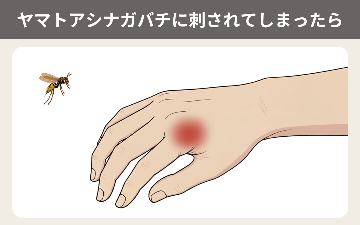 ヤマトアシナガバチに刺されてしまったら