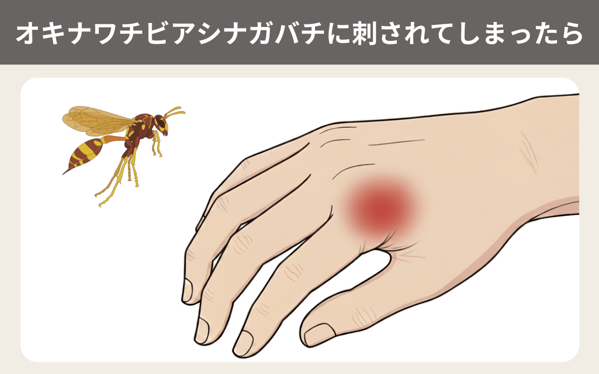 オキナワチビアシナガバチに刺されてしまったら
