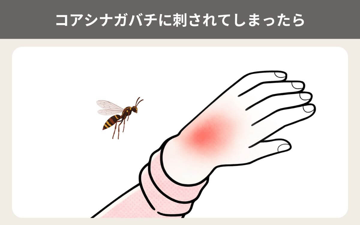 コアシナガバチに刺されてしまったら