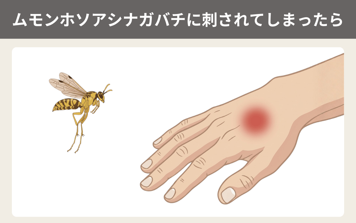 ムモンホソアシナガバチに刺されてしまったら