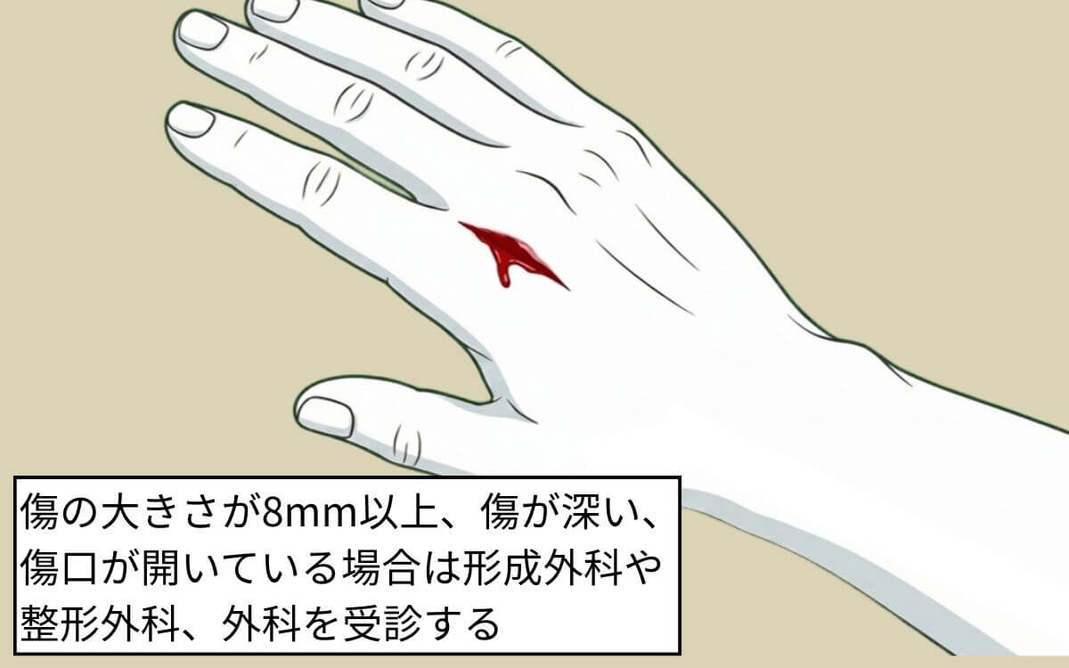【傷が8mm以上】形成外科、整形外科、外科を受診する