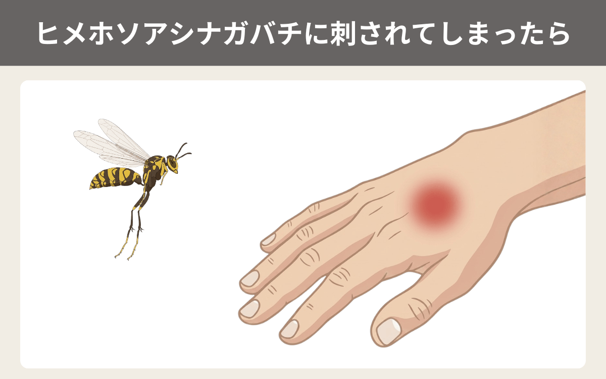 ヒメホソアシナガバチに刺されてしまったら
