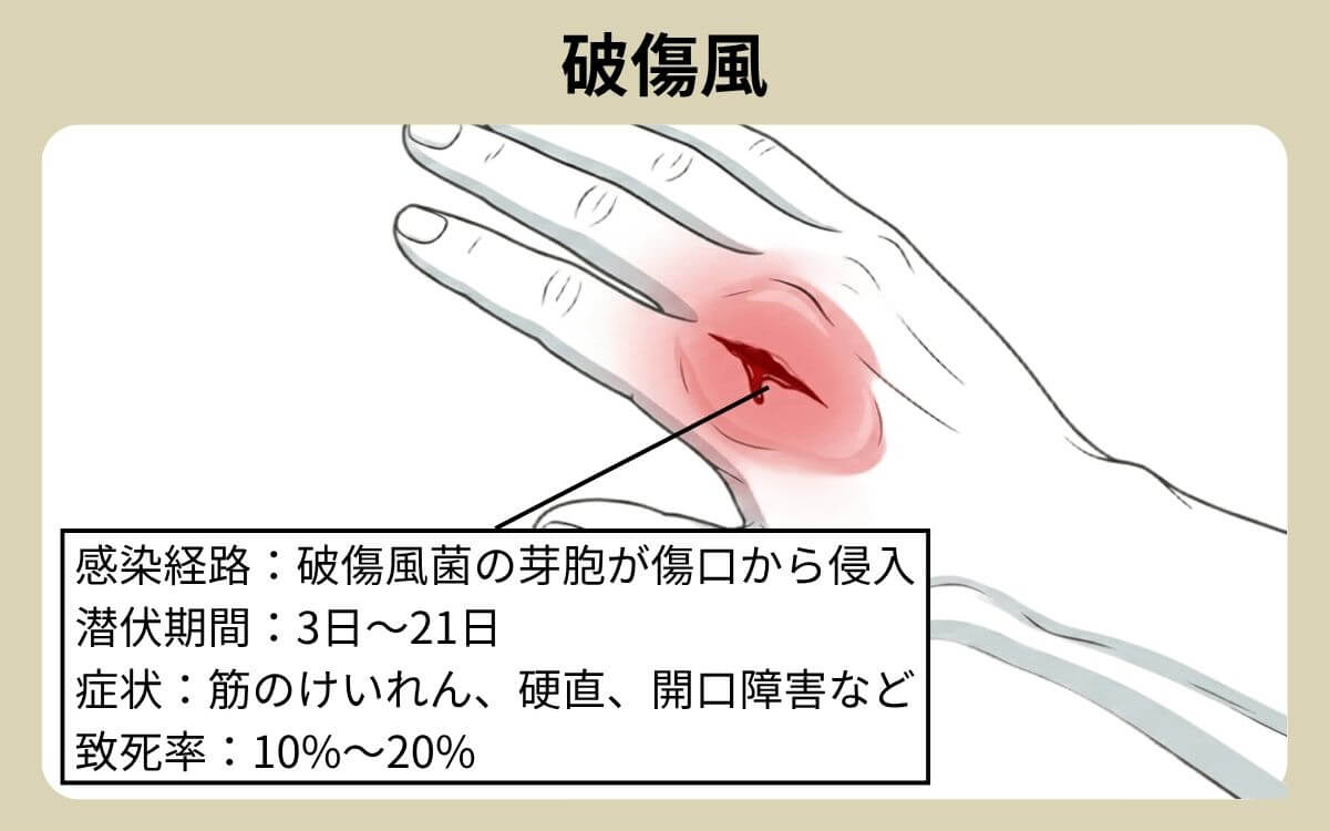 破傷風